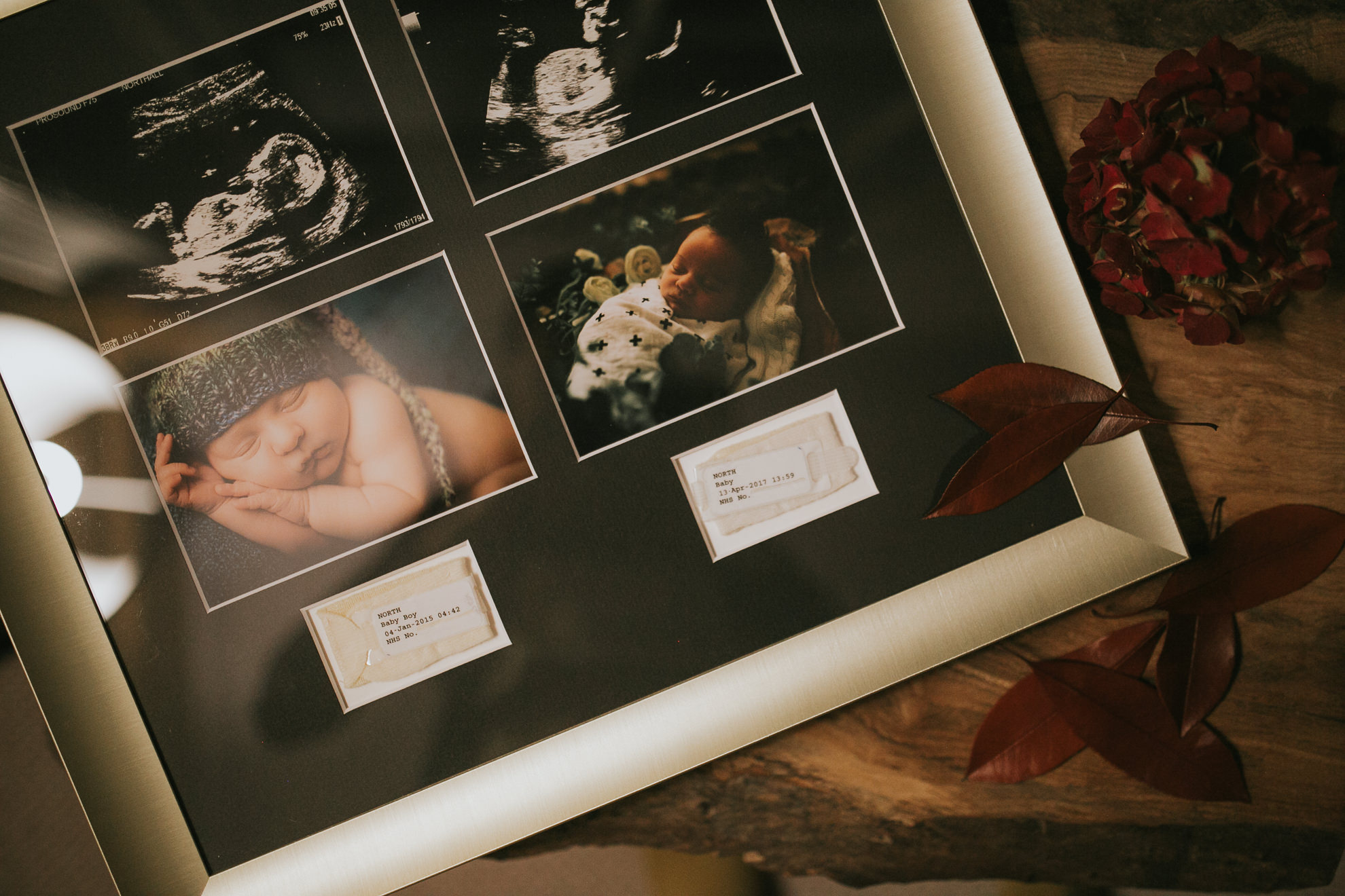 Ultra sound scan framed picture with hospital ID tag